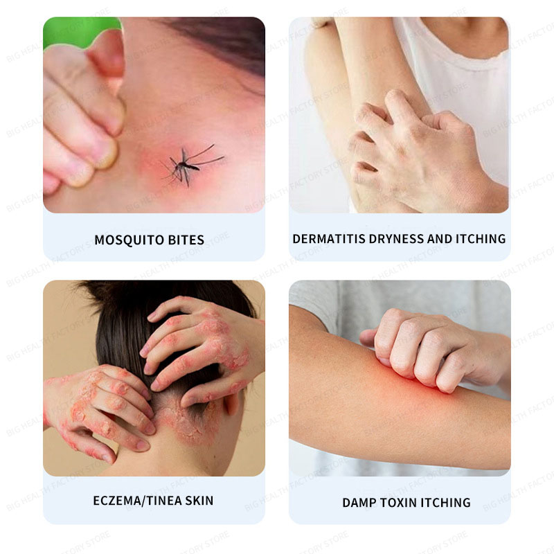Lithospermum anti-itch cream f - đánh giá và giá Diapering